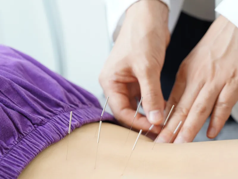 Acupuncture & Acupressure